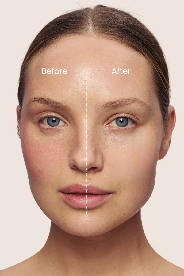 Marine Algae | Moisturizing Micellar Facial Cleansing Water Suitable for Sensitive Skin
