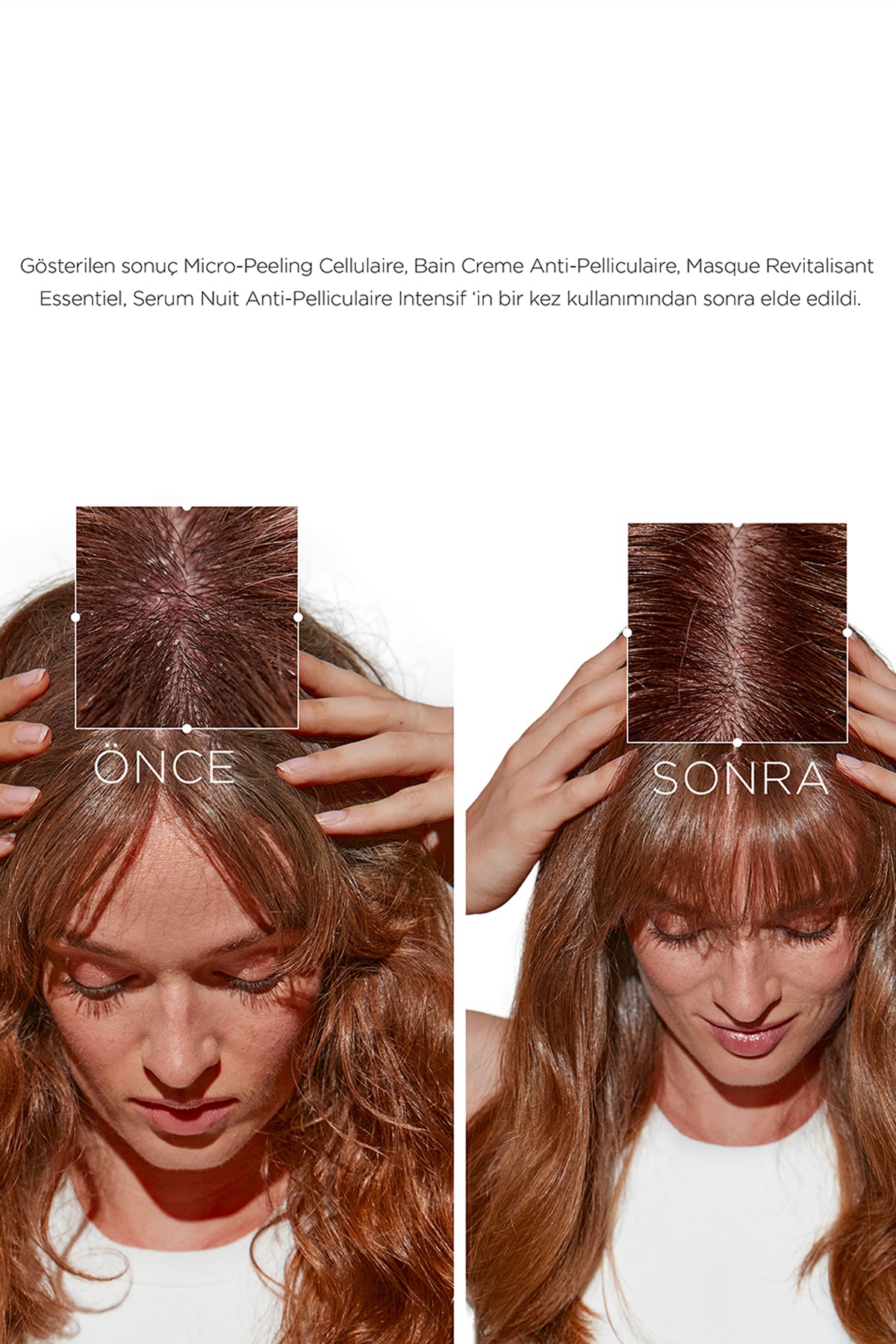 Kerastase Symbiose Moisturising Anti-Dandruff Cellular Shampoo 250ml