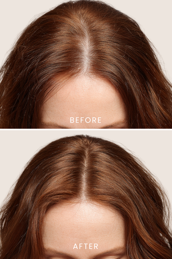 Scalpify Rosemary | Biotin Anti-Hair Loss Shampoo 350 ml